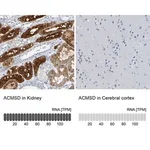 Merck Anti-ACMSD antibody produced in rabbit