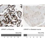 Merck Anti-LRPAP1 antibody produced in rabbit