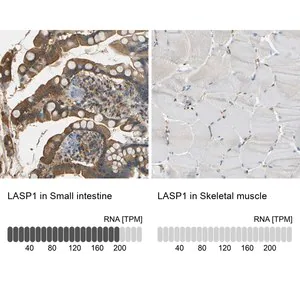 Merck Anti-LASP1 antibody produced in rabbit