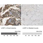Merck Anti-LASP1 antibody produced in rabbit
