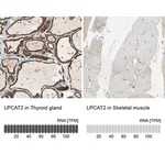 Merck Anti-LPCAT2 antibody produced in rabbit