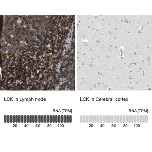 Merck Anti-LCK antibody produced in rabbit
