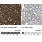 Merck Anti-ATP2B1 antibody produced in rabbit
