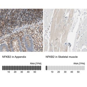 Merck Anti-NFKB2 antibody produced in rabbit