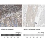 Merck Anti-NFKB2 antibody produced in rabbit