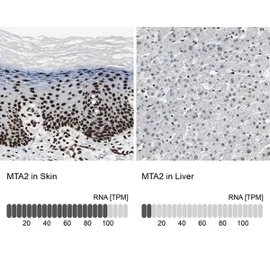 Merck Anti-MTA2 antibody produced in rabbit