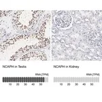 Merck Anti-NCAPH antibody produced in rabbit