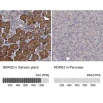 Merck Anti-NDRG2 antibody produced in rabbit
