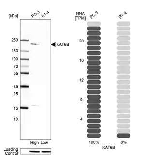 Merck Anti-KAT6B antibody produced in rabbit