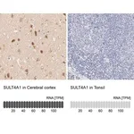 Merck Anti-SULT4A1 antibody produced in rabbit
