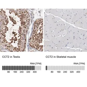 Merck Anti-CCT2 antibody produced in rabbit