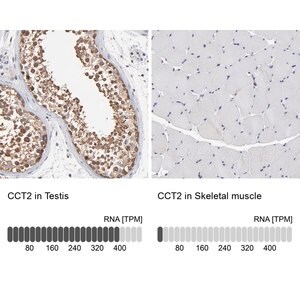 Merck Anti-CCT2 antibody produced in rabbit