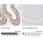Merck Anti-CCT2 antibody produced in rabbit