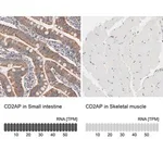 Merck Anti-CD2AP antibody produced in rabbit