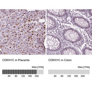 Merck Anti-CDKN1C antibody produced in rabbit