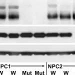 Merck Anti-NPC2 antibody produced in rabbit