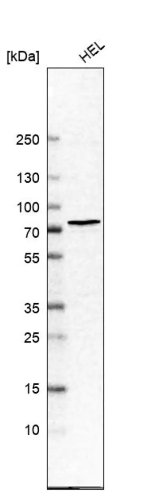 Merck Anti-CHEK2 antibody produced in rabbit