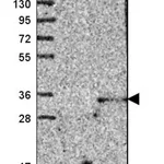 Merck Anti-CLEC4D antibody produced in rabbit