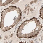 Merck Anti-OXSR1 antibody produced in rabbit