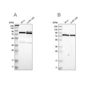 Merck Anti-PARN antibody produced in rabbit