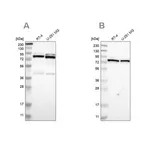 Merck Anti-PARN antibody produced in rabbit