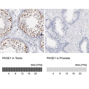 Merck Anti-PAGE1 antibody produced in rabbit