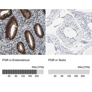 Merck Anti-PGR antibody produced in rabbit