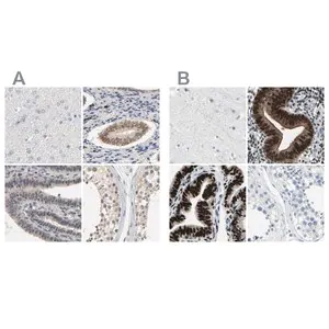 Merck Anti-PGR antibody produced in rabbit