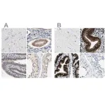 Merck Anti-PGR antibody produced in rabbit