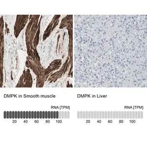 Merck Anti-DMPK antibody produced in rabbit