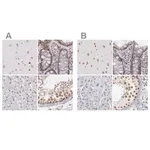 Merck Anti-DGCR14 antibody produced in rabbit