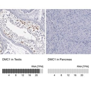 Merck Anti-DMC1 antibody produced in rabbit