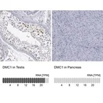 Merck Anti-DMC1 antibody produced in rabbit