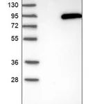 Merck Anti-PLA2G6 antibody produced in rabbit