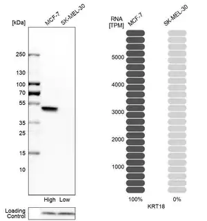 Merck Anti-KRT18 antibody produced in rabbit