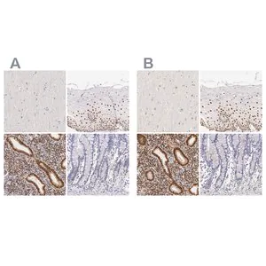 Merck Anti-ESR1 antibody produced in rabbit