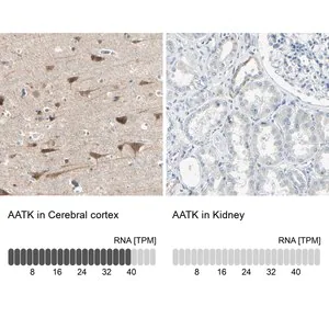 Merck Anti-AATK antibody produced in rabbit