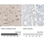 Merck Anti-AATK antibody produced in rabbit