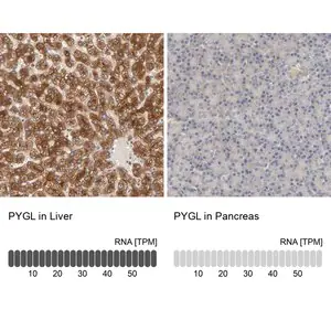 Merck Anti-PYGL antibody produced in rabbit