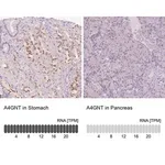 Merck Anti-A4GNT antibody produced in rabbit