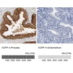 Merck Anti-ACPP antibody produced in rabbit