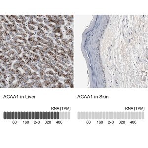 Merck Anti-ACAA1 antibody produced in rabbit