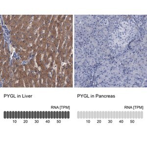 Merck Anti-PYGL antibody produced in rabbit