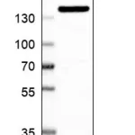 Merck Anti-AKAP1 antibody produced in rabbit