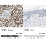 Merck Anti-ACADM antibody produced in rabbit