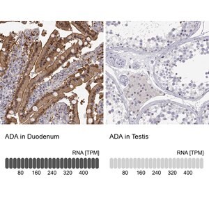 Merck Anti-ADA antibody produced in rabbit