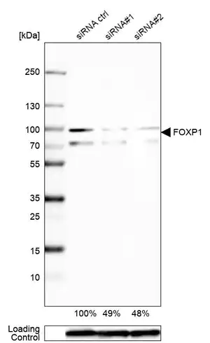 Merck Anti-FOXP1 antibody produced in rabbit