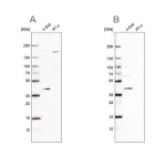 Merck Anti-GALK1 antibody produced in rabbit