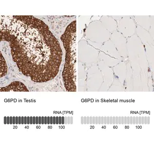 Merck Anti-G6PD antibody produced in rabbit