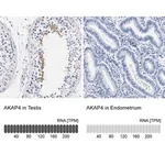 Merck Anti-AKAP4 antibody produced in rabbit